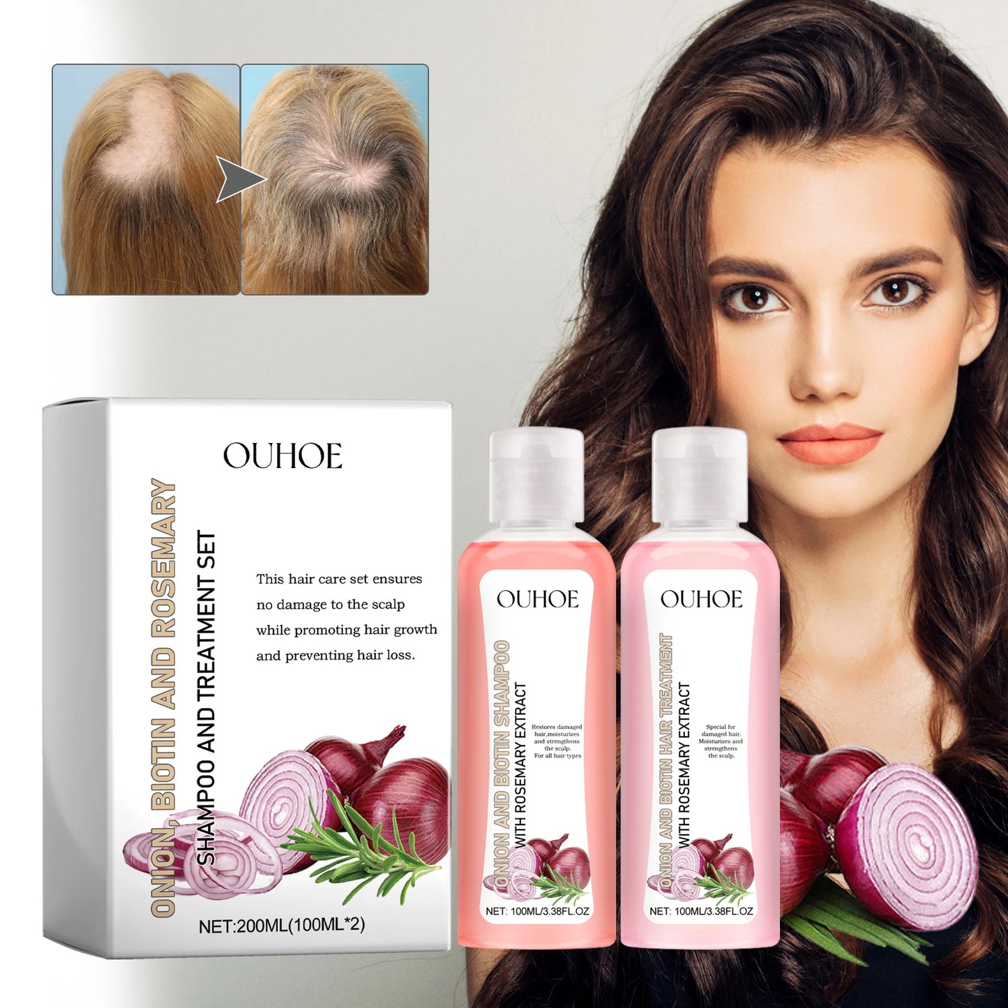 OUHOE Onion Biotin Rosemary Shampoo Set Nourishes Hair Roots Scalp Dense Hair Shiny Strengthen Promote Hair Growth Shampoo Set