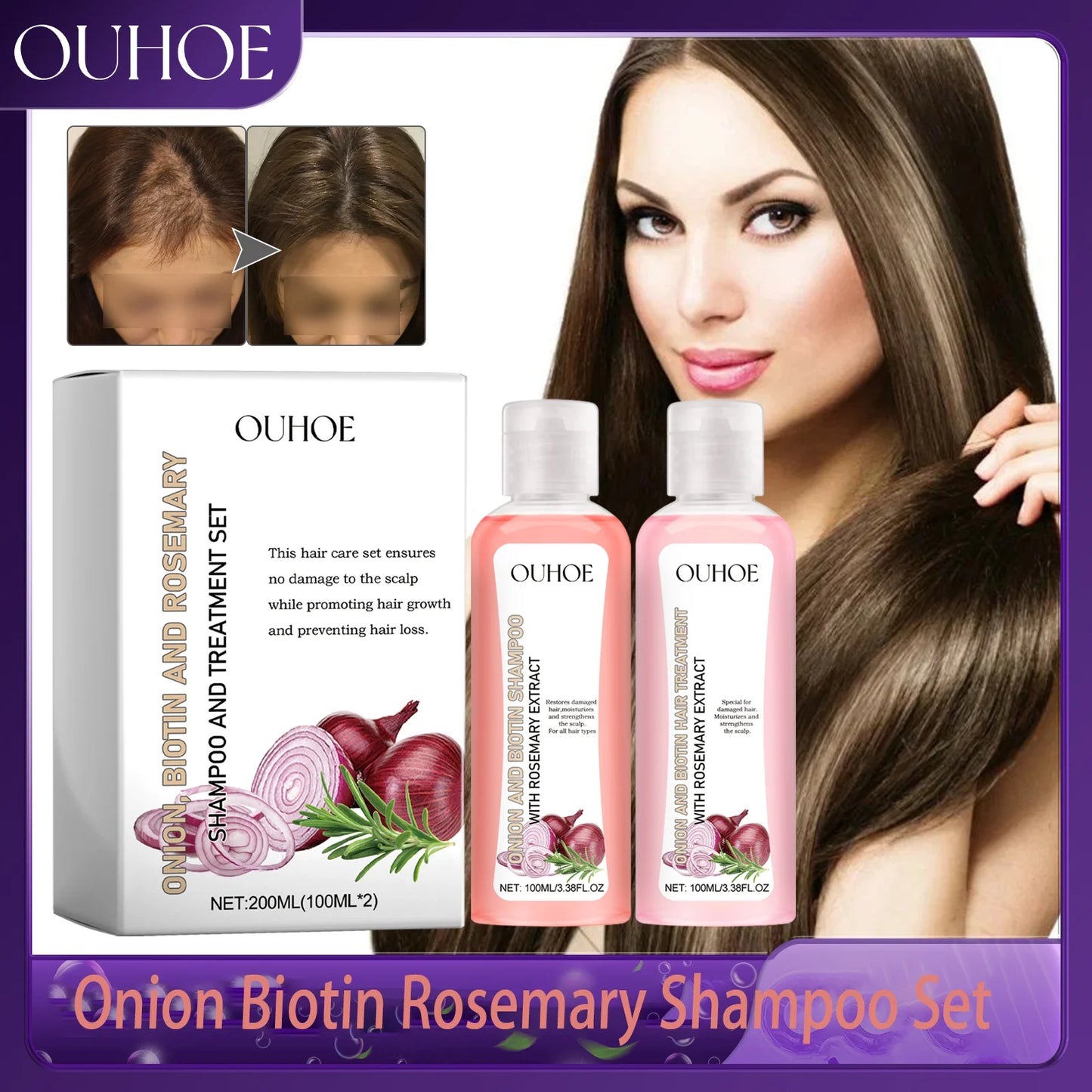 OUHOE Onion Biotin Rosemary Shampoo Set Nourishes Hair Roots Scalp Dense Hair Shiny Strengthen Promote Hair Growth Shampoo Set